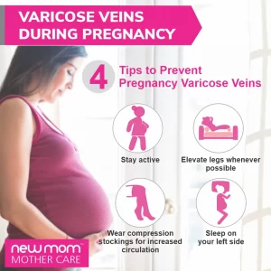 4 tips to prevent Varicose Veins During Pregnancy